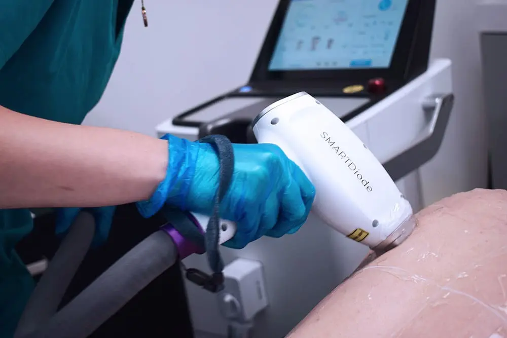 IPL or Diode Laser? Advantages of diode over IPL