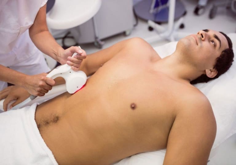 The Science Behind Laser Hair Removal