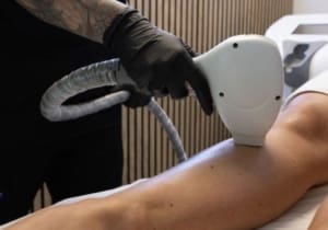 Which Laser Hair Removal Machine Is The Best?