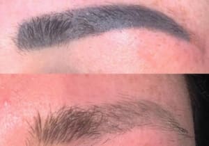 Why Is Microblading Removal Becoming So Popular