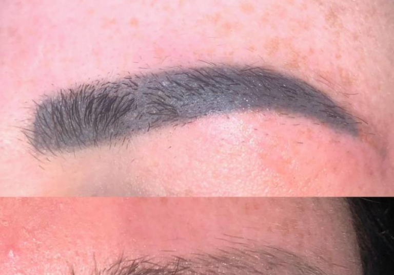 Why Is Microblading Removal Becoming So Popular