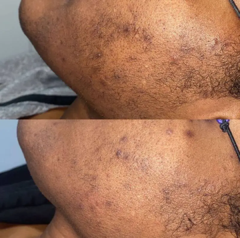 half face completed package