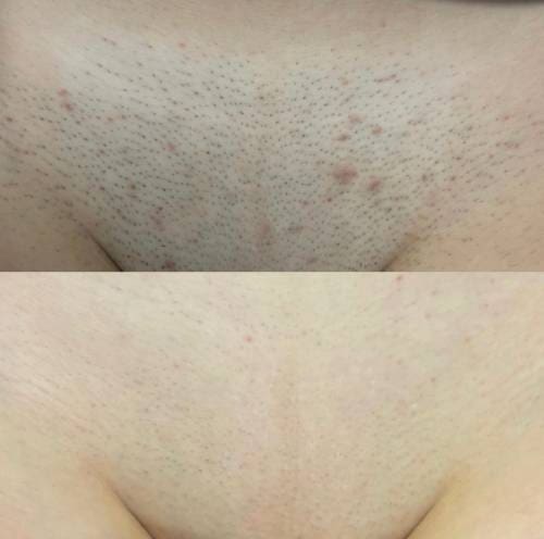 Hollywood 4 sessions