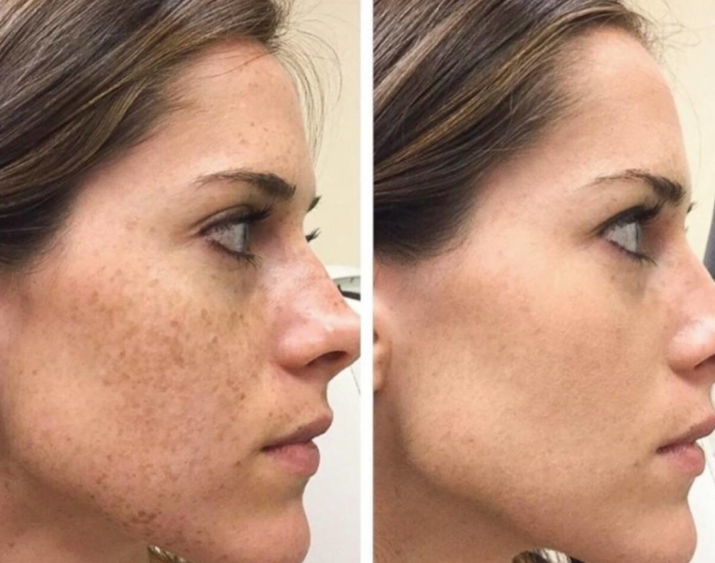 Sun Damage in Cheshire