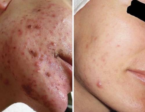 Sun Damage in Cheshire