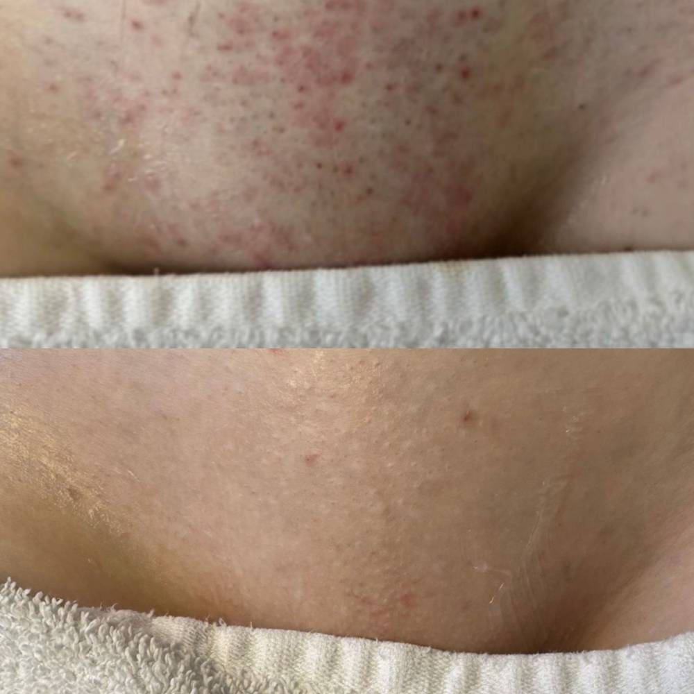 Hollywood package 5 sessions