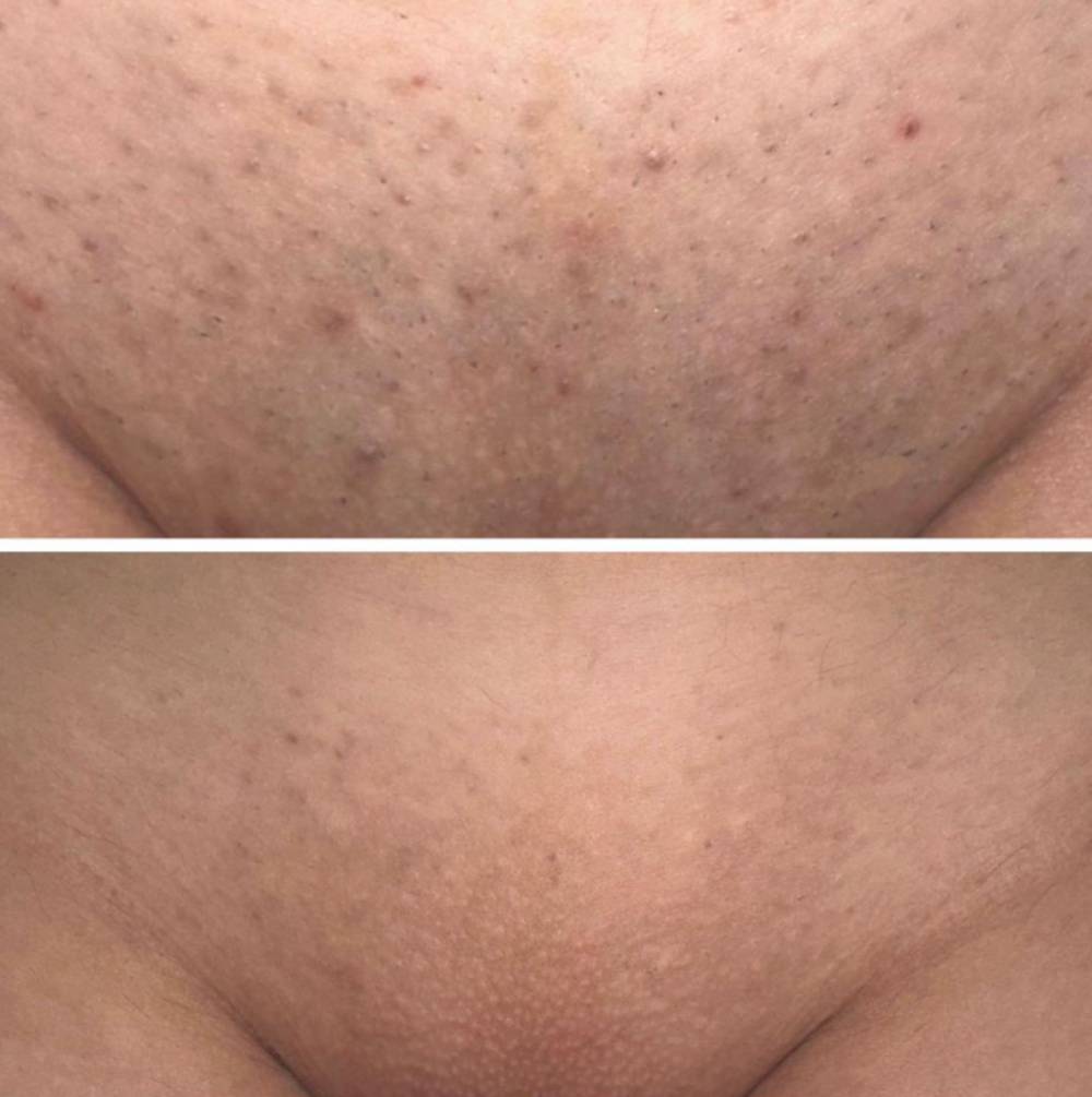 completed Hollywood package