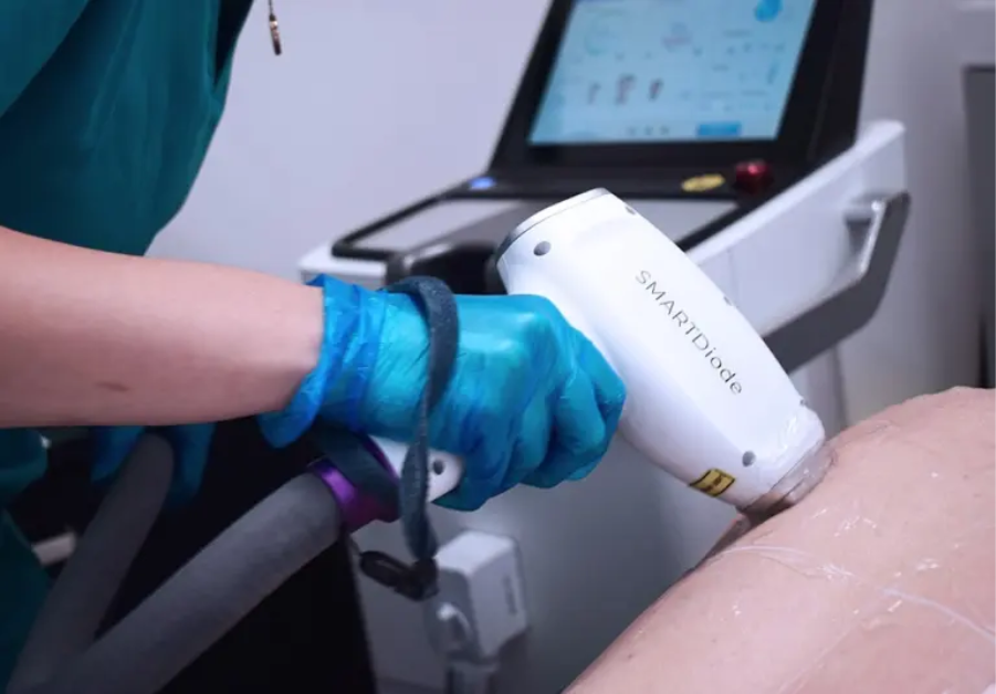 laser-hair-removal-leeds-expert-treatments-at-the-laser-club