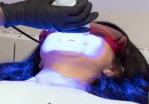 How Dublin Clinics Combine Technology and Expertise for Optimal Teeth Whitening Results