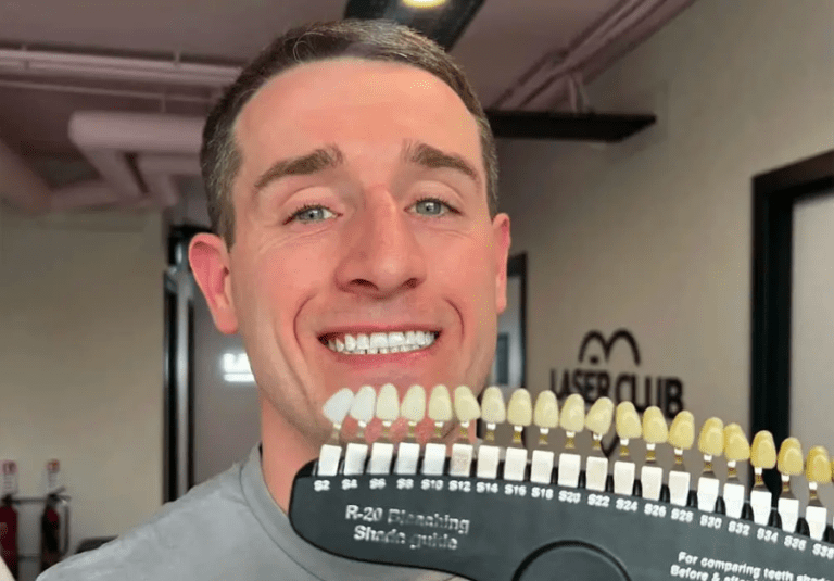 Teeth whitening Manchester