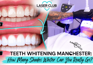 Teeth Whitening Manchester: How Many Shades Whiter Can You Really Go?