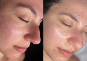 Professional skin care treatments