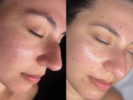 Professional skin care treatments