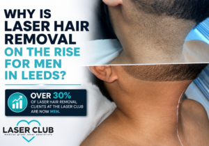 Why Is Laser Hair Removal on the Rise for Men in Leeds?