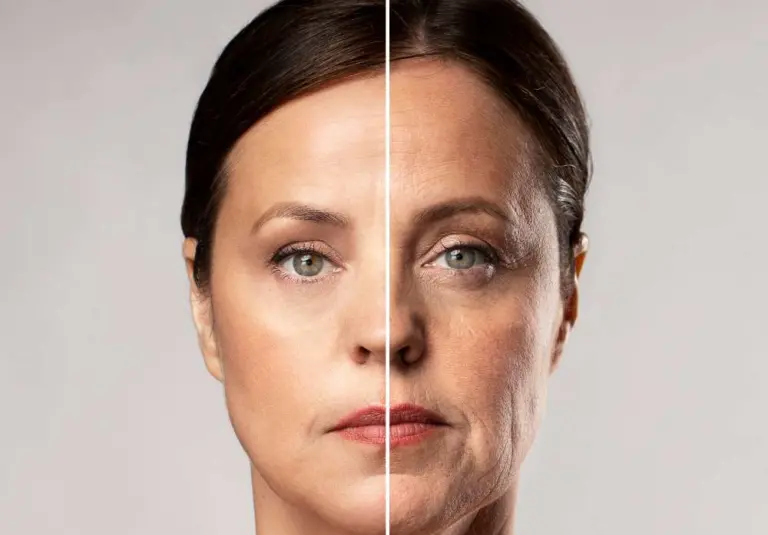 Skin Tightening Guide