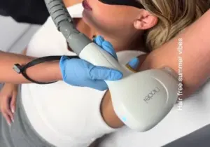 Laser Hair Removal in Manchester
